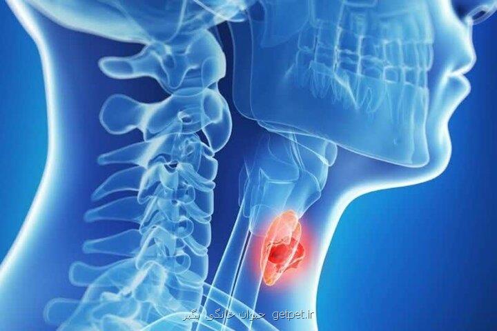 زنان بیش از مردان گرفتار سرطان تیروئید می شوند